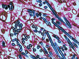  H5N1