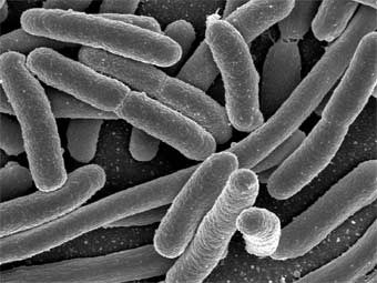   E. coli.    universityofcalifornia.edu