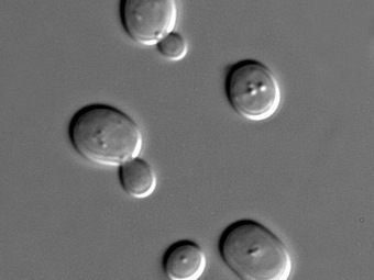 Sacharomyces cerevisiae.   Masur   wikipedia.org